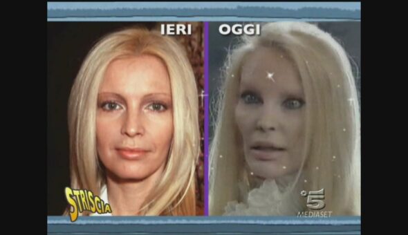 Fatti e rifatti: Patty Pravo