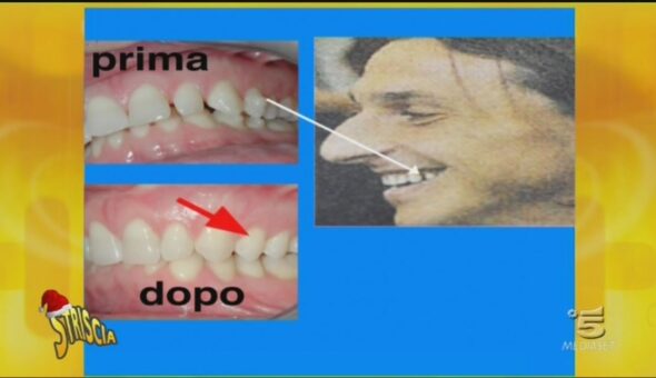 I denti dei Vip