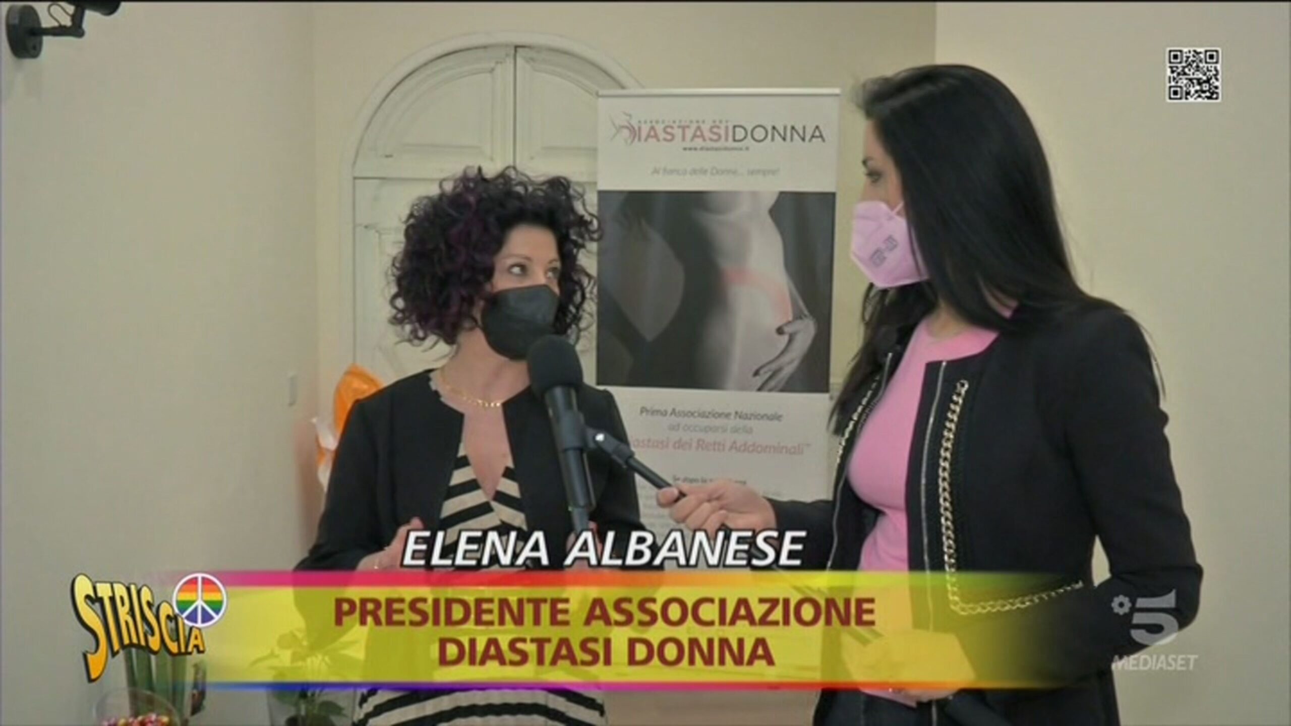 Che cos’è la diastasi