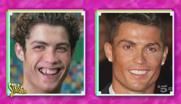 Cristiano Ronaldo e i ritocchini: lo scanner test di 