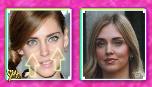 Chiara Ferragni è davvero immune ai ritocchini? Parola al verdetto di “Fatti e Rifatti”